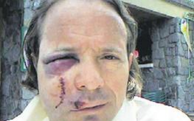 9-годишният син на лекаря на Шалке спаси живота на баща си