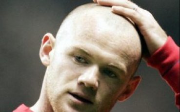 Рууни взе мерки срещу оплешивяването