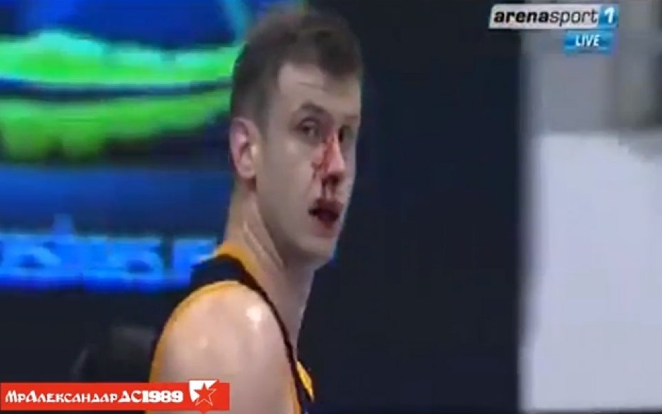ВИДЕО: Счупен нос не спира Величкович за мач срещу Звезда