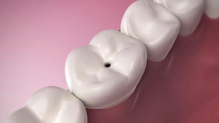 зъб зъболекар стоматолог