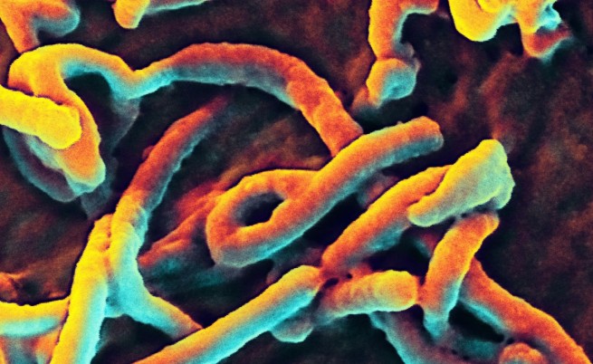 Вероятността ебола да се предава по въздушно-капков път е много малка