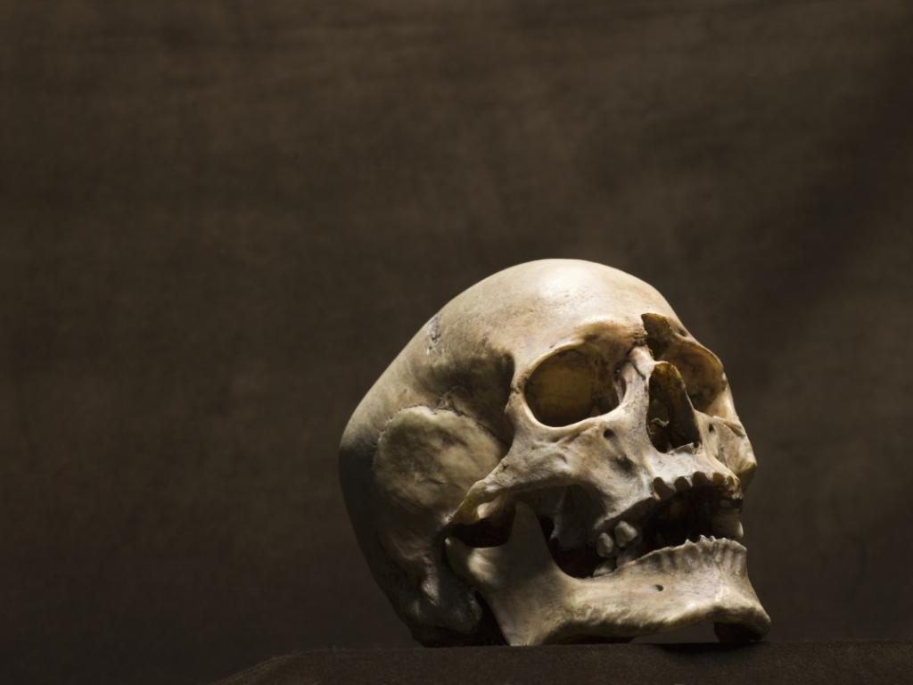 Археолози са открили уникален медицински протезен имплант забит в черепа