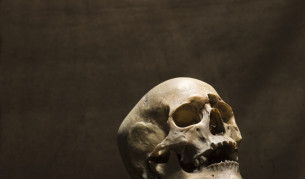 Археолози откриха уникална находка в череп от XVIII в.