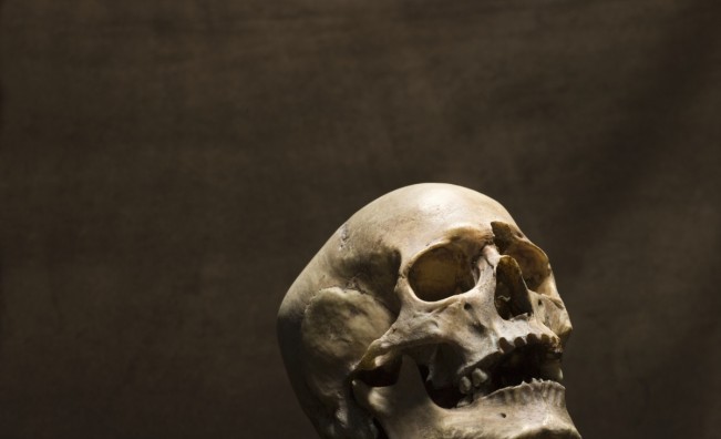 Археолози откриха уникална находка в череп от XVIII в.