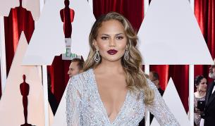 Модел показва бедра със стрии и синини (снимкa)