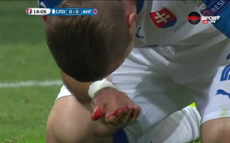 Кървища: Пекарик отнесе страшен лакът в лицето