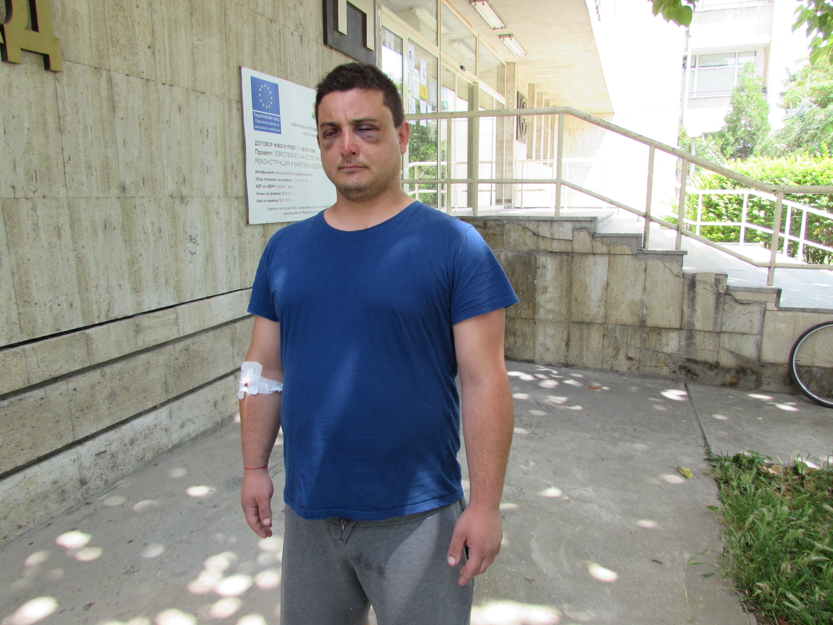 28-годишният Антон Спасов е настанен в болница с множество травми, най-вече по главата, след сблъсък с роми, крали сливи посред нощ