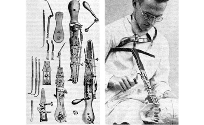  Остеотомът и неговите съставни елементи 