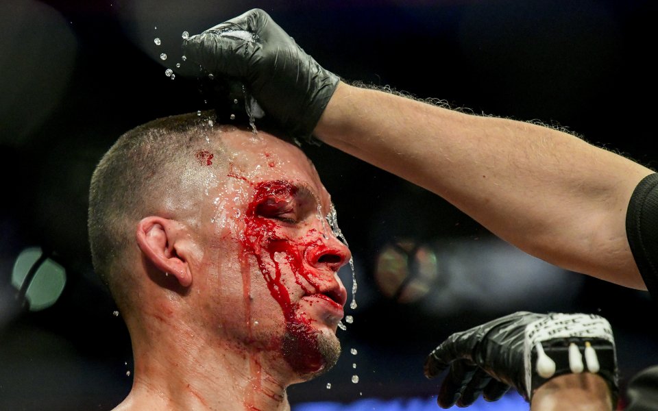 ММА боецът Нейт Диас загуби от Хорхе Масвидал в главната