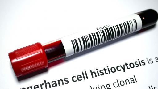  <p>Смъртоносна човешка болест в динозавър на 66 млн. г.</p> 