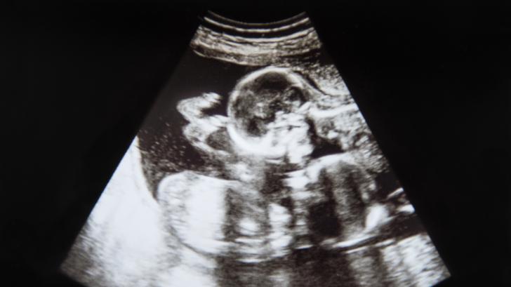 Загуба на близнак в утробата: какви са рисковете?