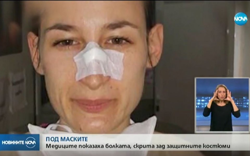 Вижте белезите и какво им се случва, но не се отказват