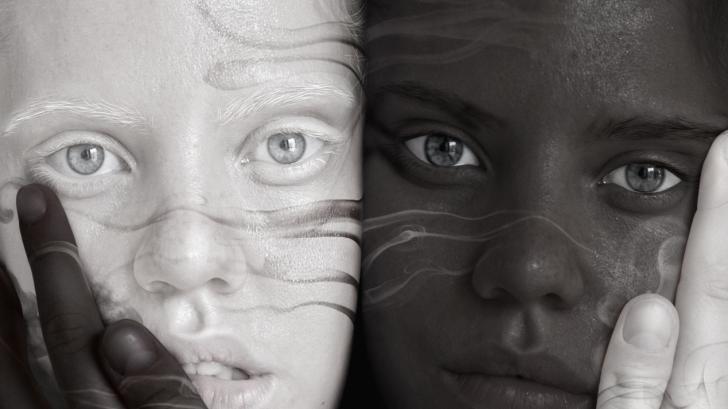 Невероятната история на близнаците с различен цвят на кожата