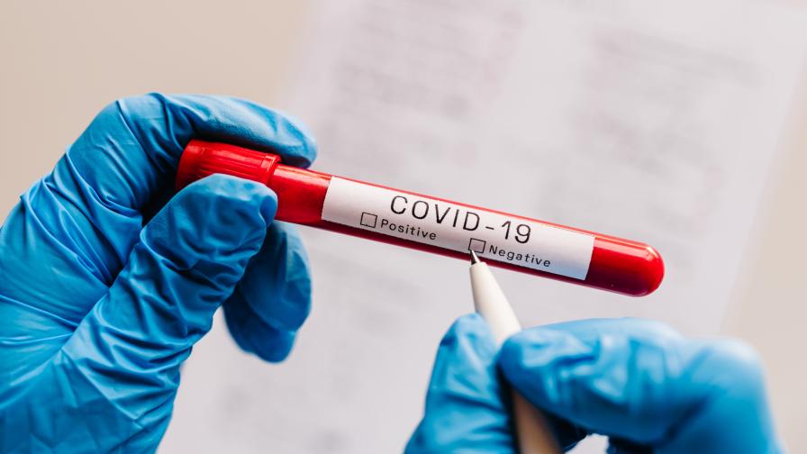 COVID-19: 24% от направените проби за денонощието са положителни