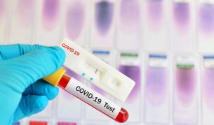 130 нови случаи на COVID-19, 6 области без новозаразени