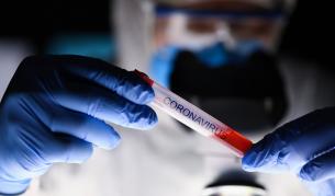 Коронавирус: Предпазва ли ни имунната система