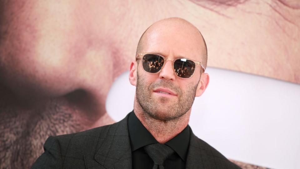 Доскоро мъжете не искаха да говорят за оплешивяването, приемаха го