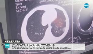 Как коронавирусът засяга нервната ни система