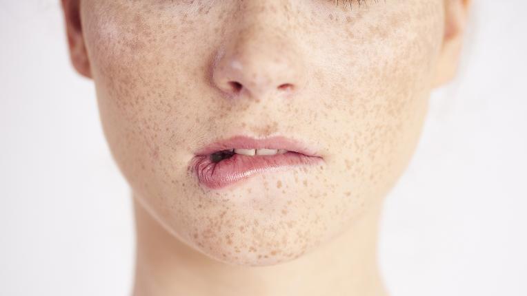  6 знака, че имате здравословен проблем, които устните разкриват 