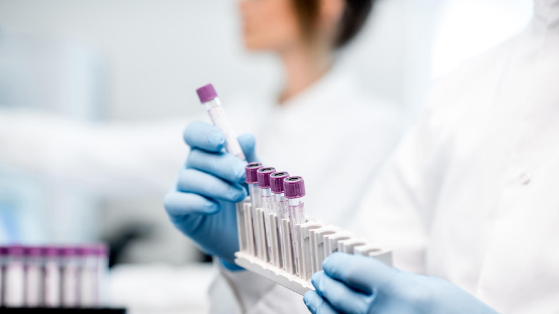 Ръст на случаите на COVID 19 у нас през последните дни