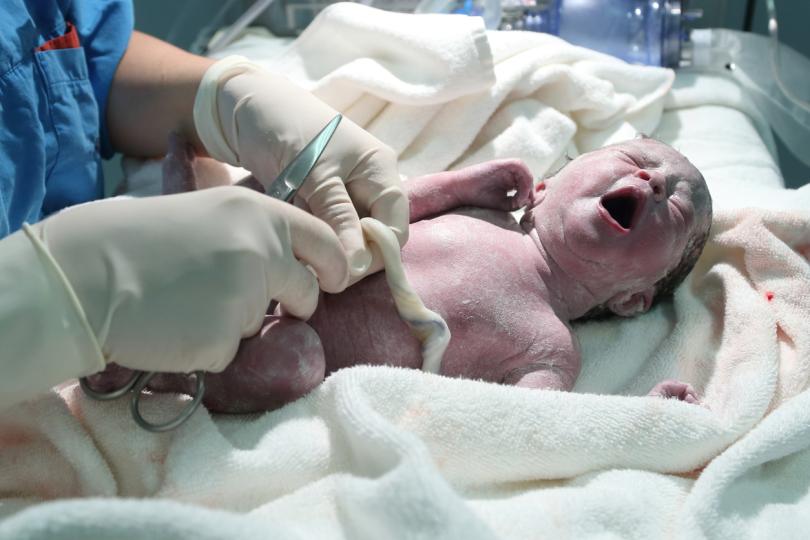 Как изглеждат наистина новородените - РЕАЛНИ СНИМКИ