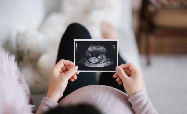 За първи път: Близнаци се родиха от замразен ембрион на 30 год.