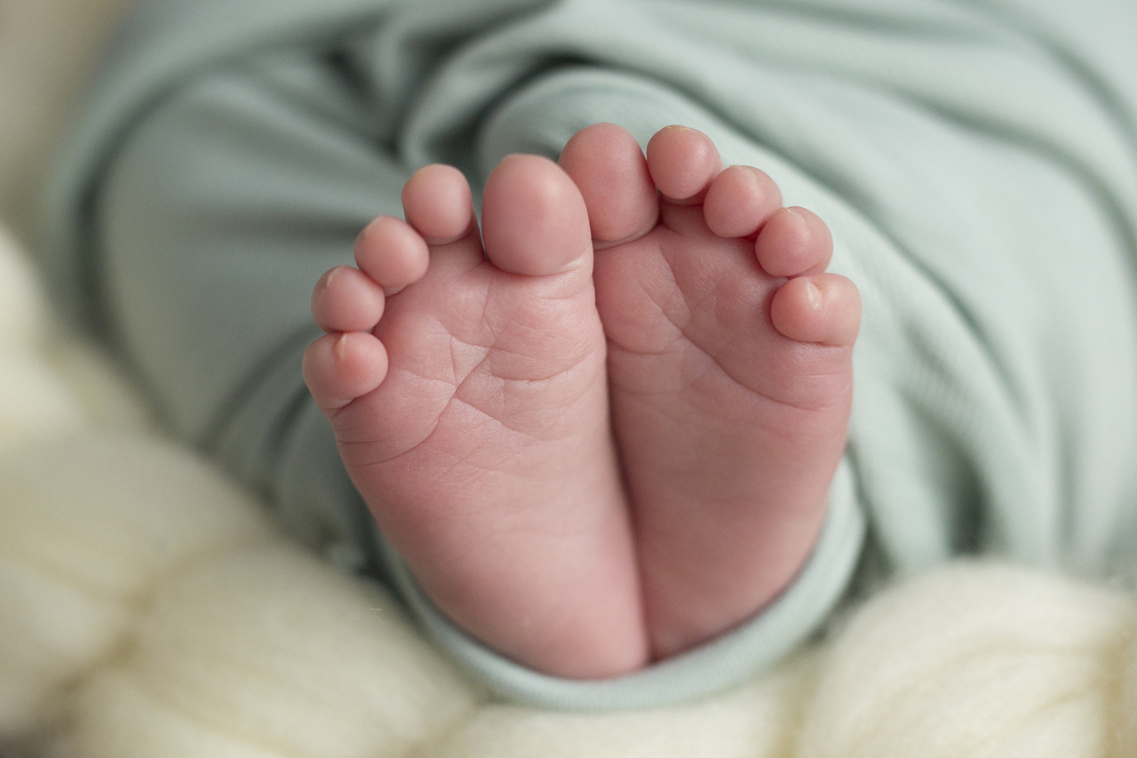 <p><strong>Вродените дефекти са чести</strong><br />
Според Центровете за контрол и превенция на заболяванията вродените дефекти засягат едно на всеки 33 бебета, родени в Съединените щати всяка година. Това означава, че близо 120 000 новородени са засегнати от вродени аномалии годишно.<br />
В световен мащаб около 3-6% от бебетата се раждат със сериозен вроден дефект. Освен това, приблизително 240 000 новородени по света умират всяка година в рамките на 24 часа след раждането поради вродени дефекти, съобщава Световната здравна организация (СЗО).</p>