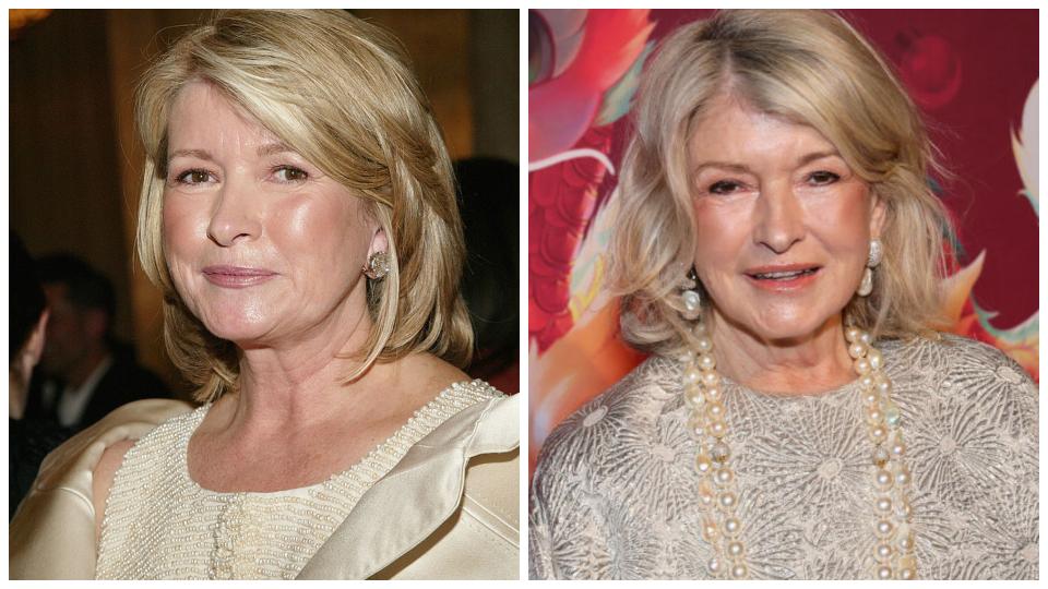 Наскоро в своя подкаст Марта Стюарт описа подробно козметичните процедури,