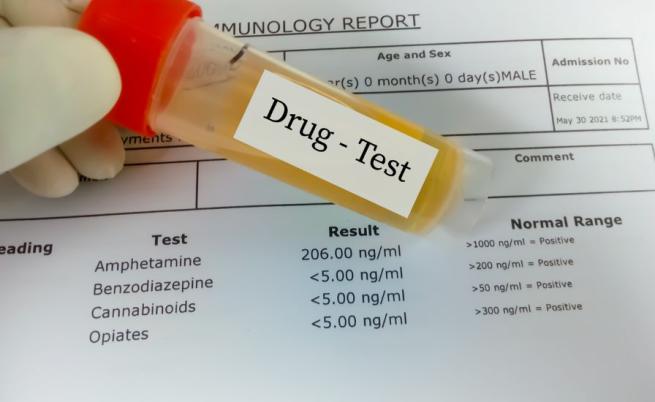 Заради фалшив тест за дрога: Шофьор заведе иск за 50 хил. лв. срещу държавата