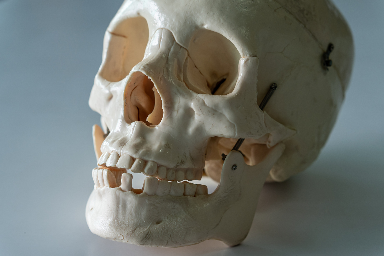 Мистерия в Бостън: Череп в бетон разпали теории за мафиотско убийство