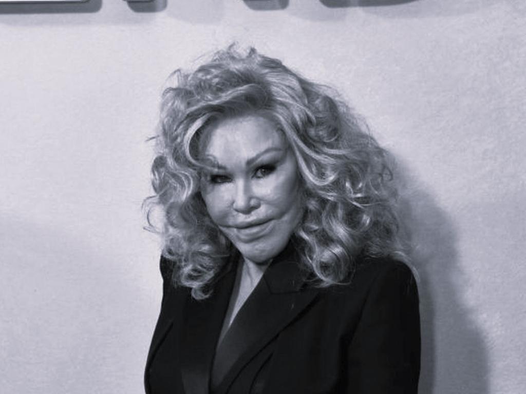 Джоселин Вилденщайн известна като жената котка заради многобройните си козметични