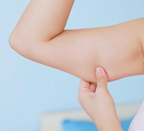 Когато чуем за отслабване с над 30 килограма често си