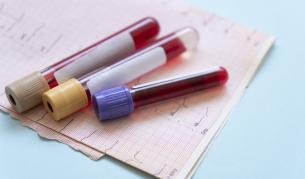 Учени откриха скрита промяна в кръвта, причиняваща дълъг COVID