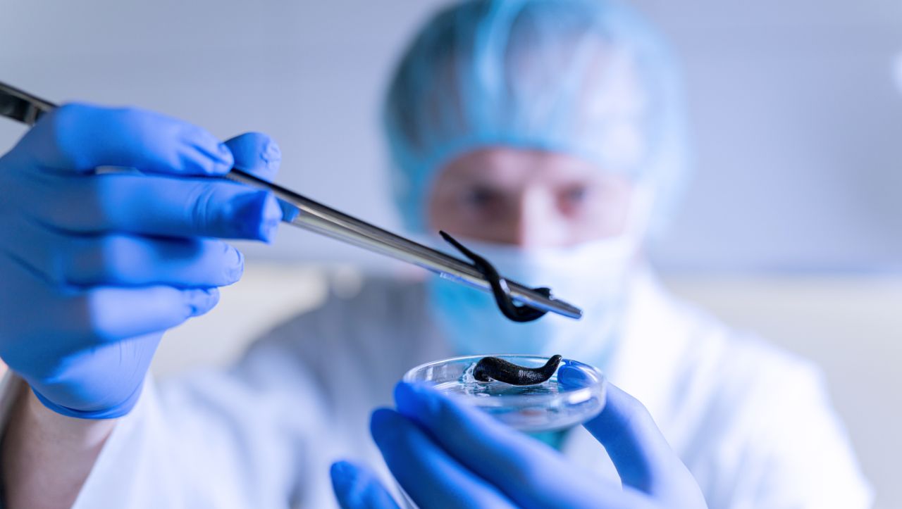 След 20 дни на тревожни симптоми: Откриха пиявица в ноздрите на пациент