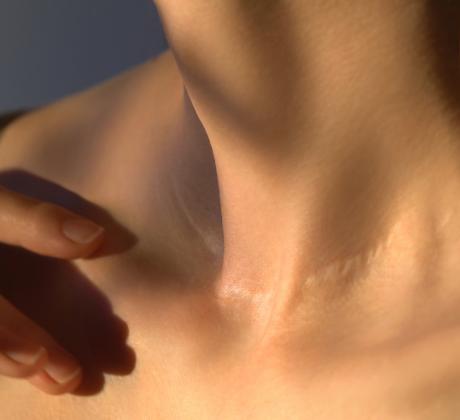 Всеки белег на кожата разказва история Не всяка история обаче