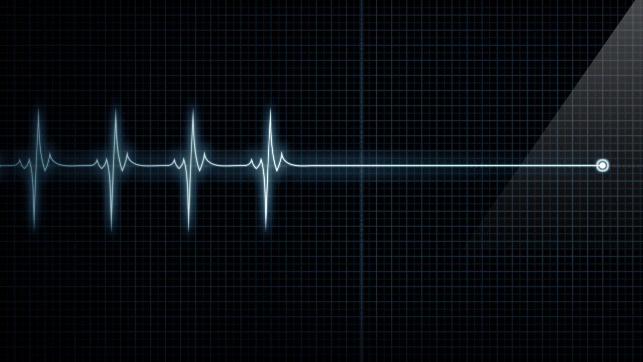 Възможно ли е да видиш собствената си смърт: Жена се върна към страшно преживяване с хипноза и смая лекарите
