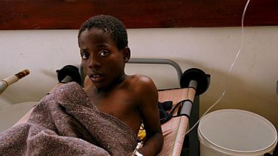 Болно от холера момченце в Зимбабве.