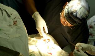 В "Пирогов" оперирали лява вместо дясна ръка