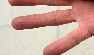 Насекомо, което може да ви отхапе пръста