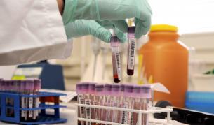 Младо момче се нуждае спешно от кръв АВ отрицателна