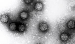 ЧПВ се свързва с една трета от случаите на рак на гърлото