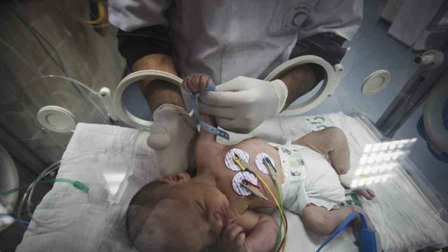 Бебе се роди здраво от майка в мозъчна смърт в Унгария